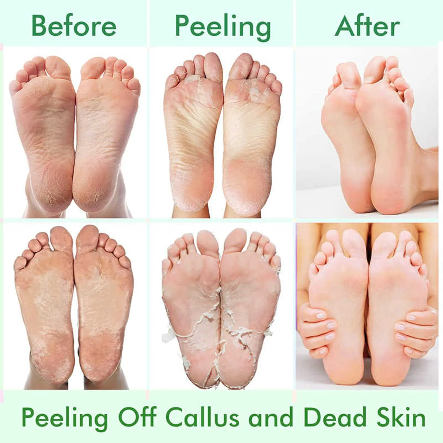5 Pack Foot Peel Mask,Exfoliator Peel Off Calluses Dead Skin Callus Remover,Foot Mask for Dry Cracked Feet,Foot Peel Mask with Lavender and Aloe Vera Gel for Men and Women Feet Peeling Mask