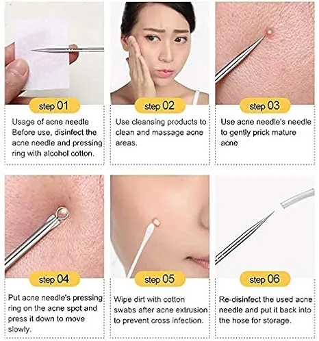 Abhijeet enterprises Stainless Steel Blackhead Remover Pimple Blemish Extractor Remover Tool Set of 4