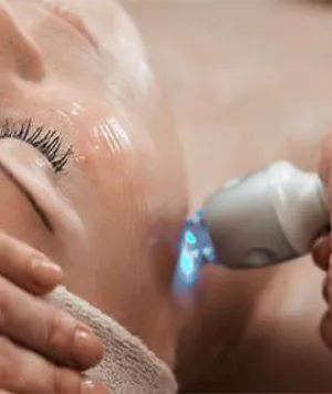 Acne Care in Brides