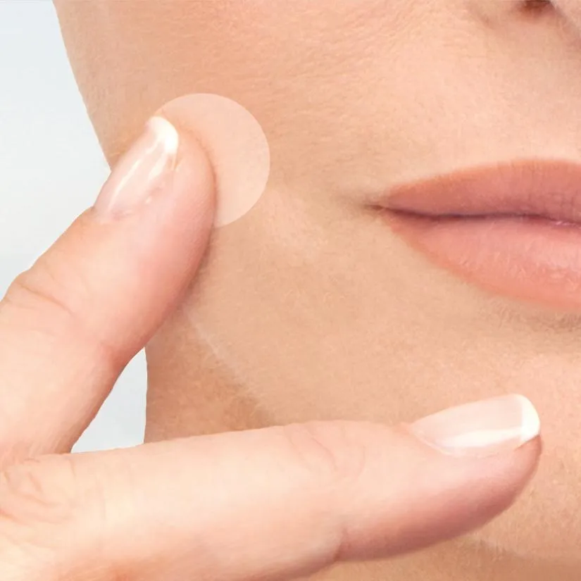 Acne-Clear Invisible Dots