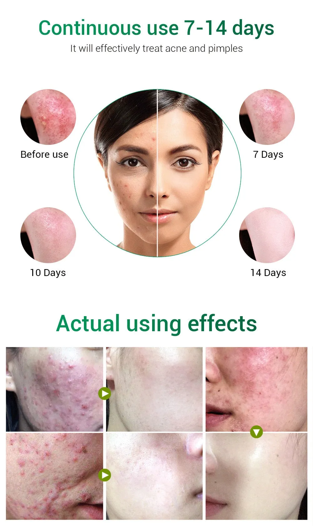 Acne Pimple Patch Face Mask Skin Care Serum Face Cream Mask Facial Care Tools