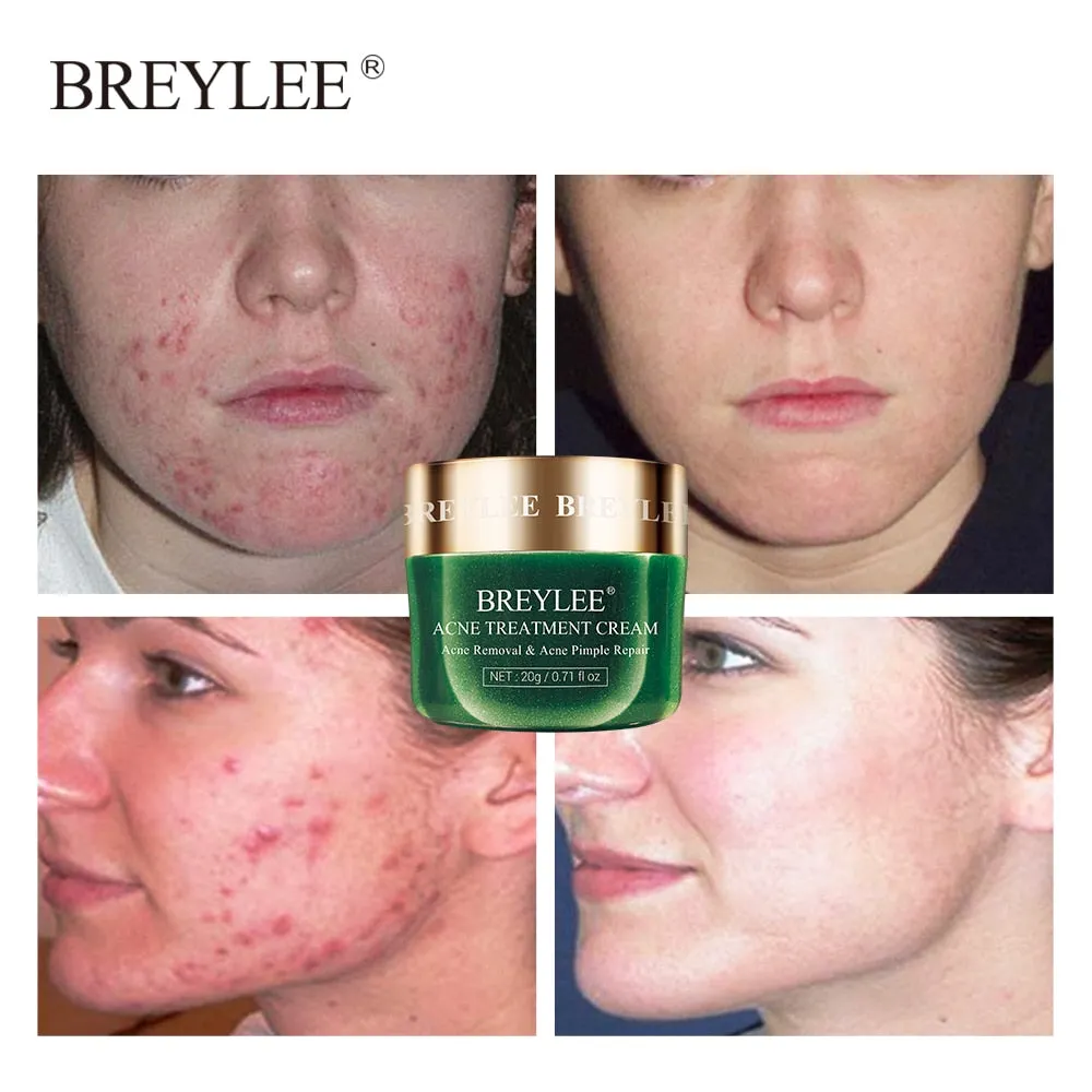 Acne Pimple Patch Face Mask Skin Care Serum Face Cream Mask Facial Care Tools
