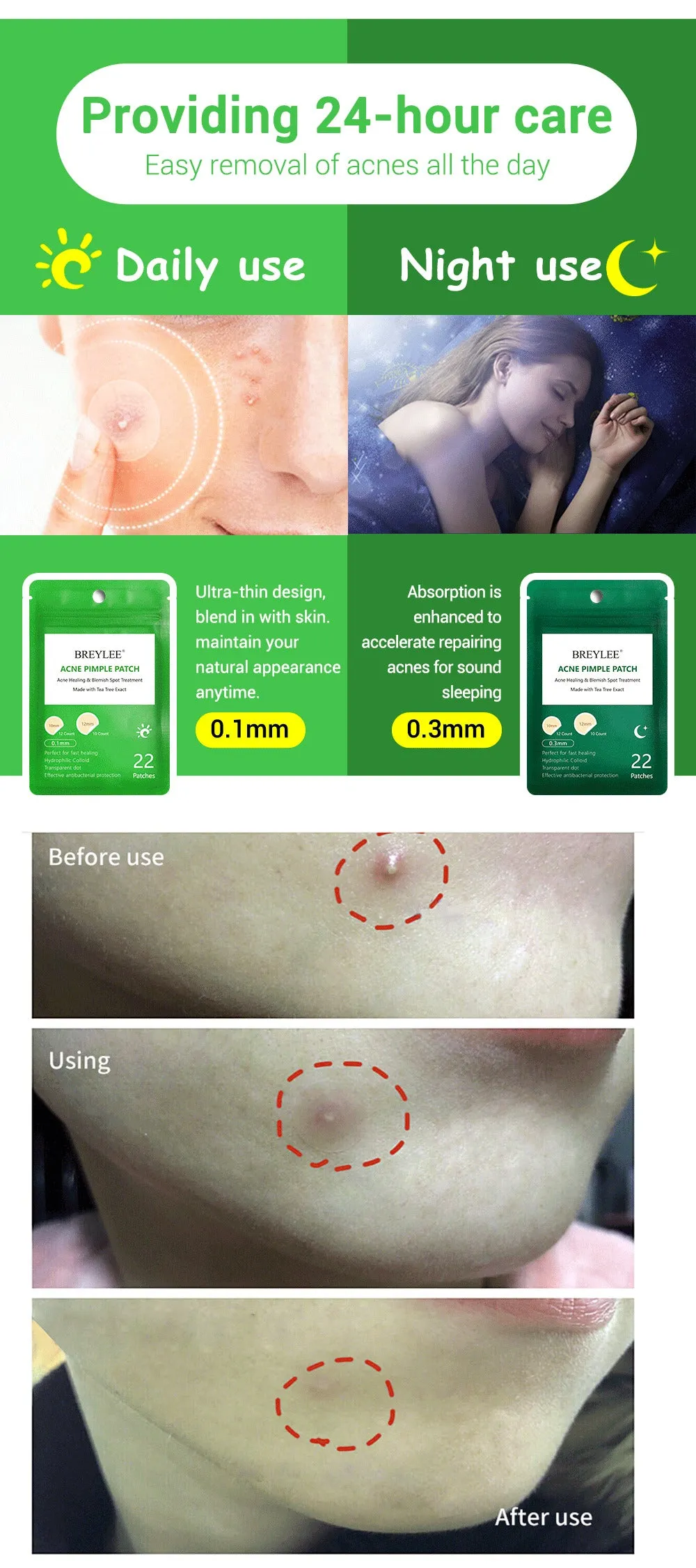 Acne Pimple Patch Face Mask Skin Care Serum Face Cream Mask Facial Care Tools