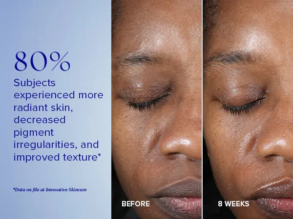 Active Peel System