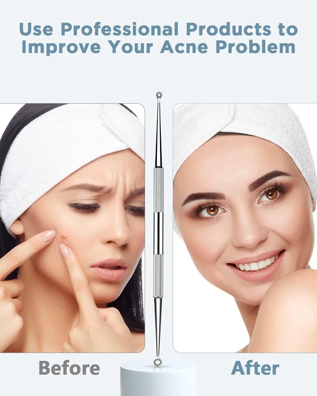 American Best  Blackhead Remover Tool, Pimple Popper Tool Kit, Blackhead Extractor Tool For Face