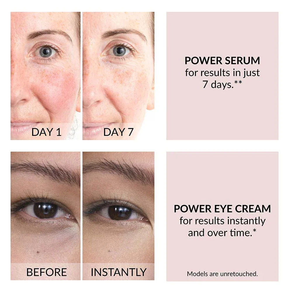 Avon Anew Renewal Power Duo Serum & Eye Cream Set