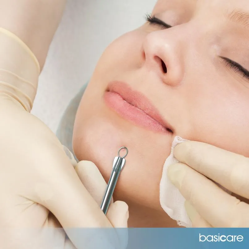 Basicare Black Head Remover With Loop