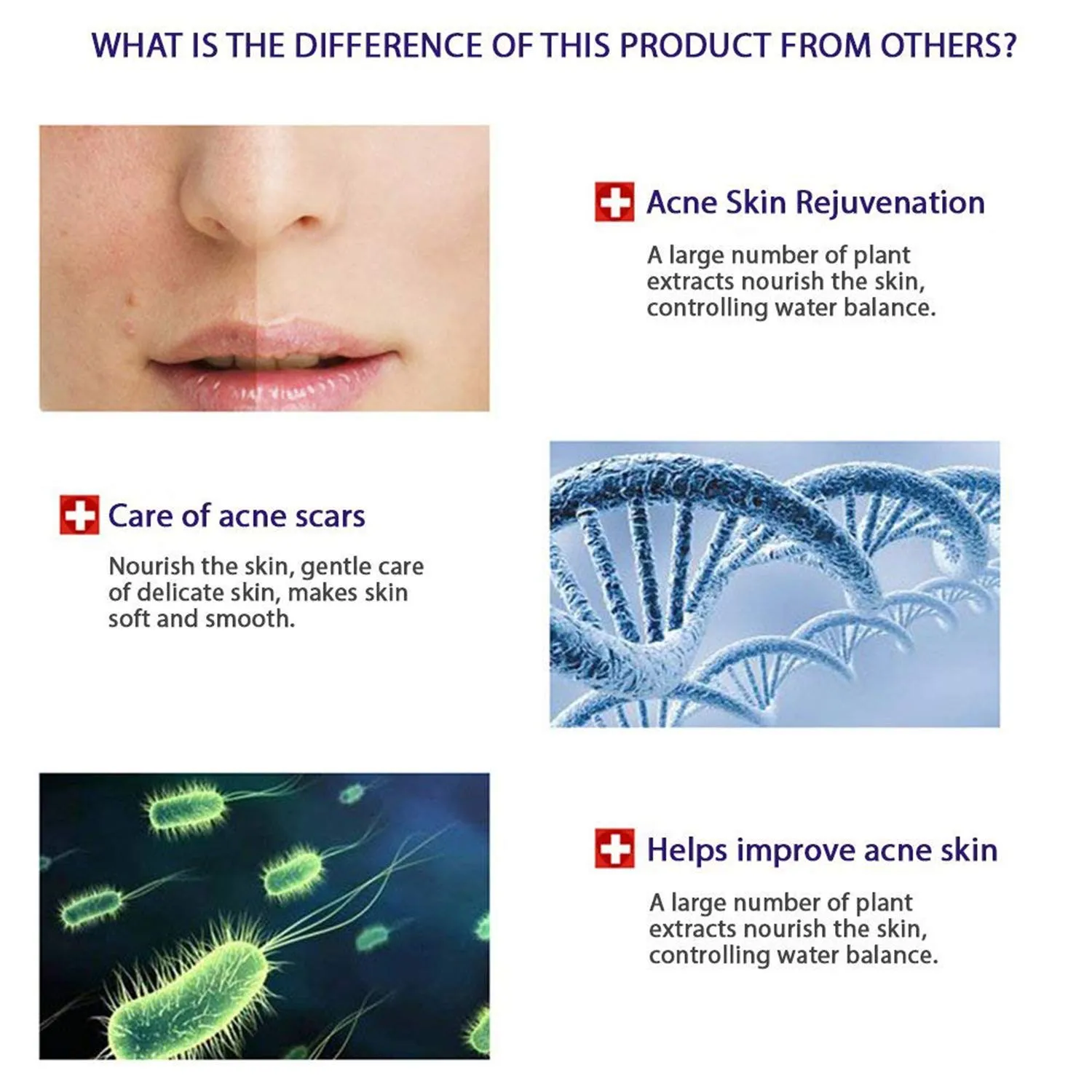 BIOAQUA 4in1 Face Acne Scar Removal Spots Pimples Oil Cream Face Masks Scar Blemish Marks Moisturizing Oil 100g 30g 30ml 4pcs X30g