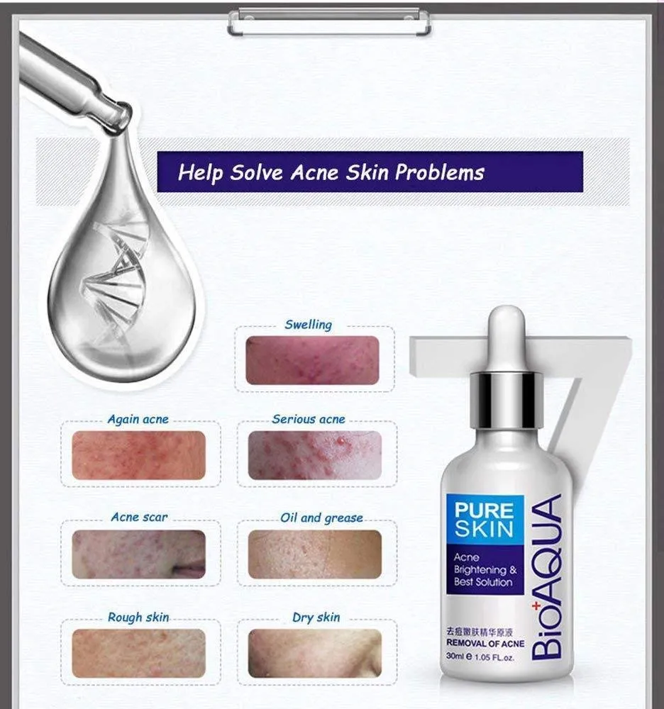 BIOAQUA 4in1 Face Acne Scar Removal Spots Pimples Oil Cream Face Masks Scar Blemish Marks Moisturizing Oil 100g 30g 30ml 4pcs X30g