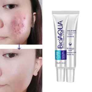 Bioaqua face cream skin care anti acne treatment cream 30g -100% ORIGINAL