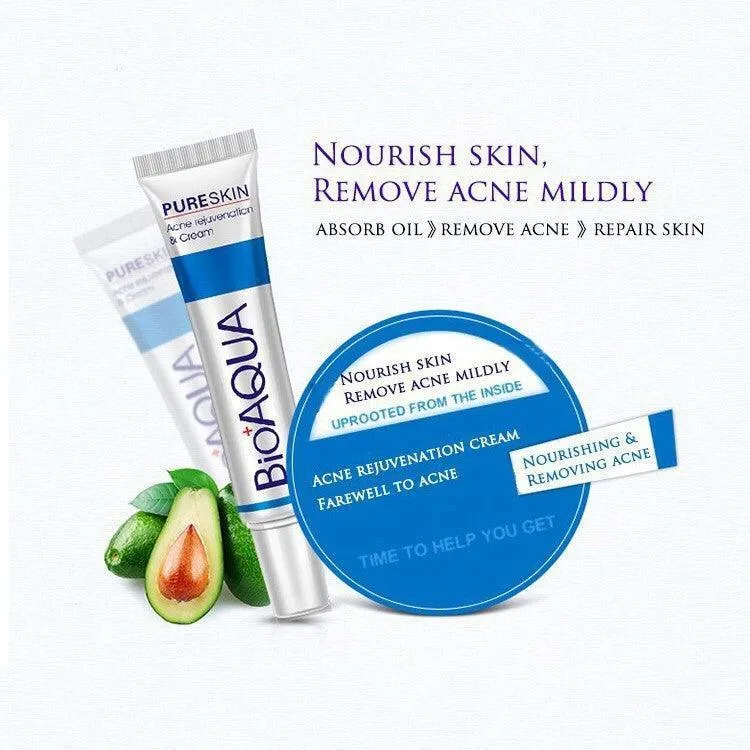 Bioaqua face cream skin care anti acne treatment cream 30g -100% ORIGINAL