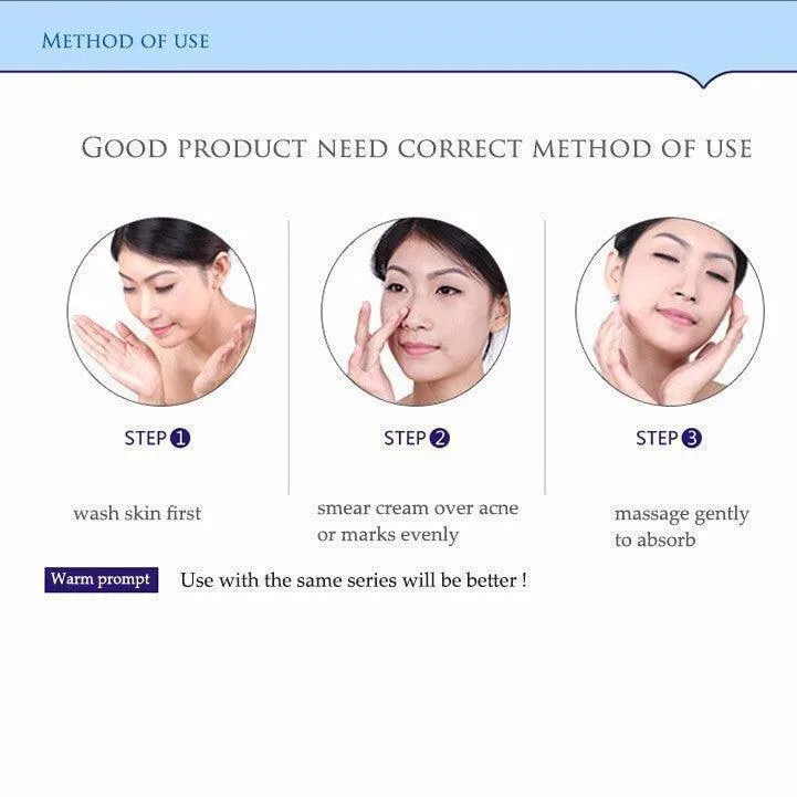 Bioaqua face cream skin care anti acne treatment cream 30g -100% ORIGINAL