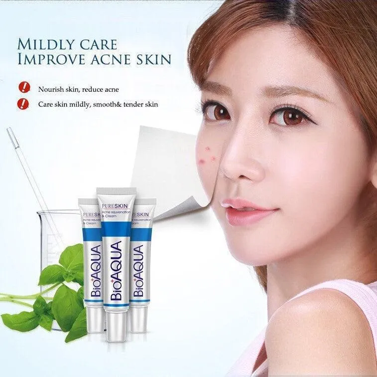 Bioaqua face cream skin care anti acne treatment cream 30g -100% ORIGINAL