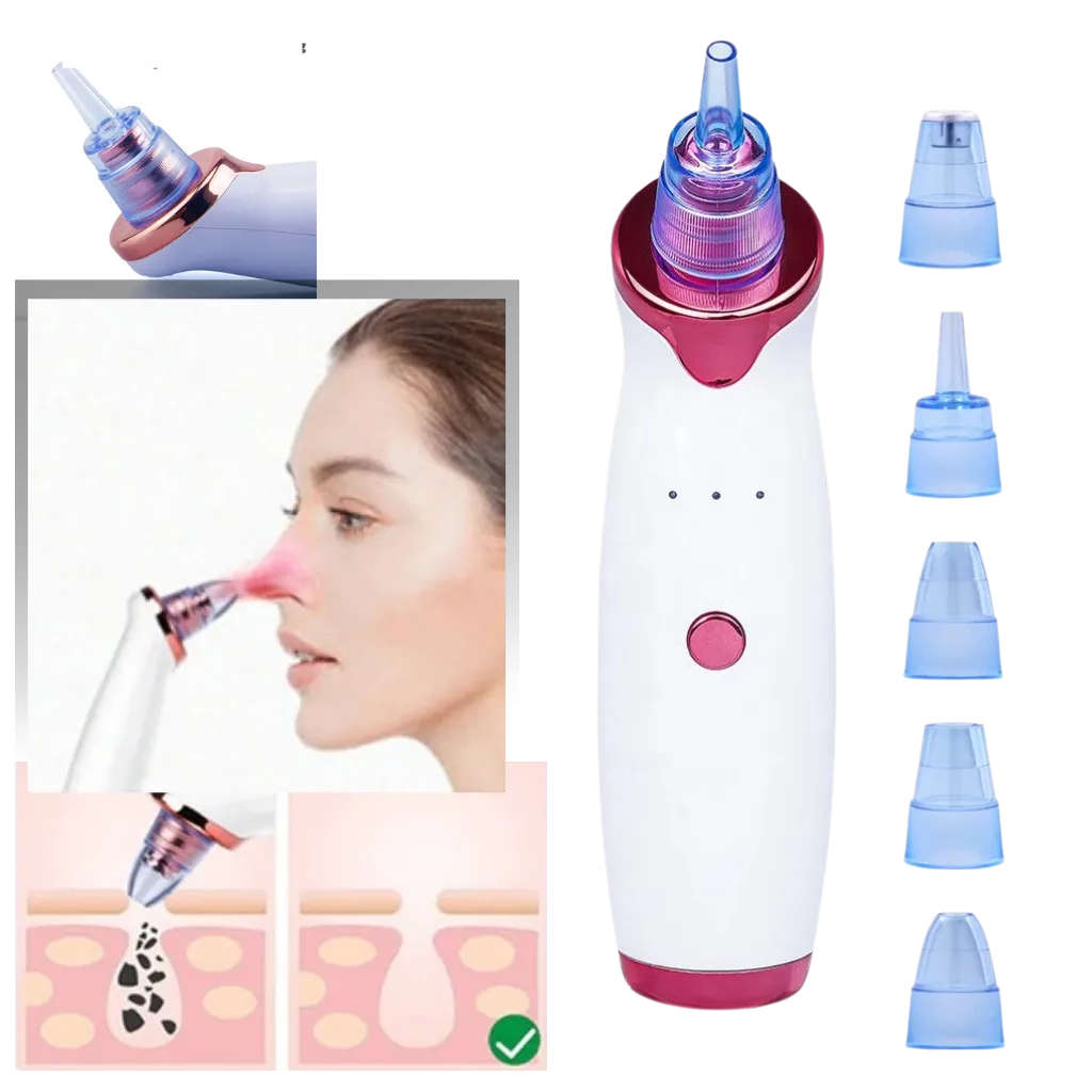 Blackhead Pore Remover Vacuum