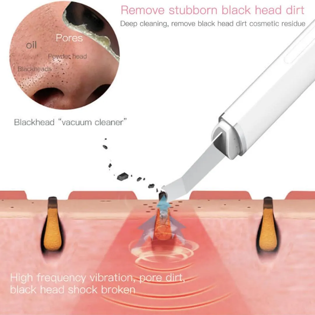Blackhead Remover – Powerful Suction, Clear Skin Fast!