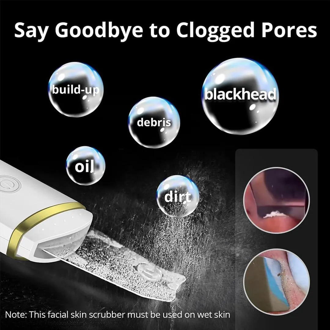 Blackhead Remover – Powerful Suction, Clear Skin Fast!