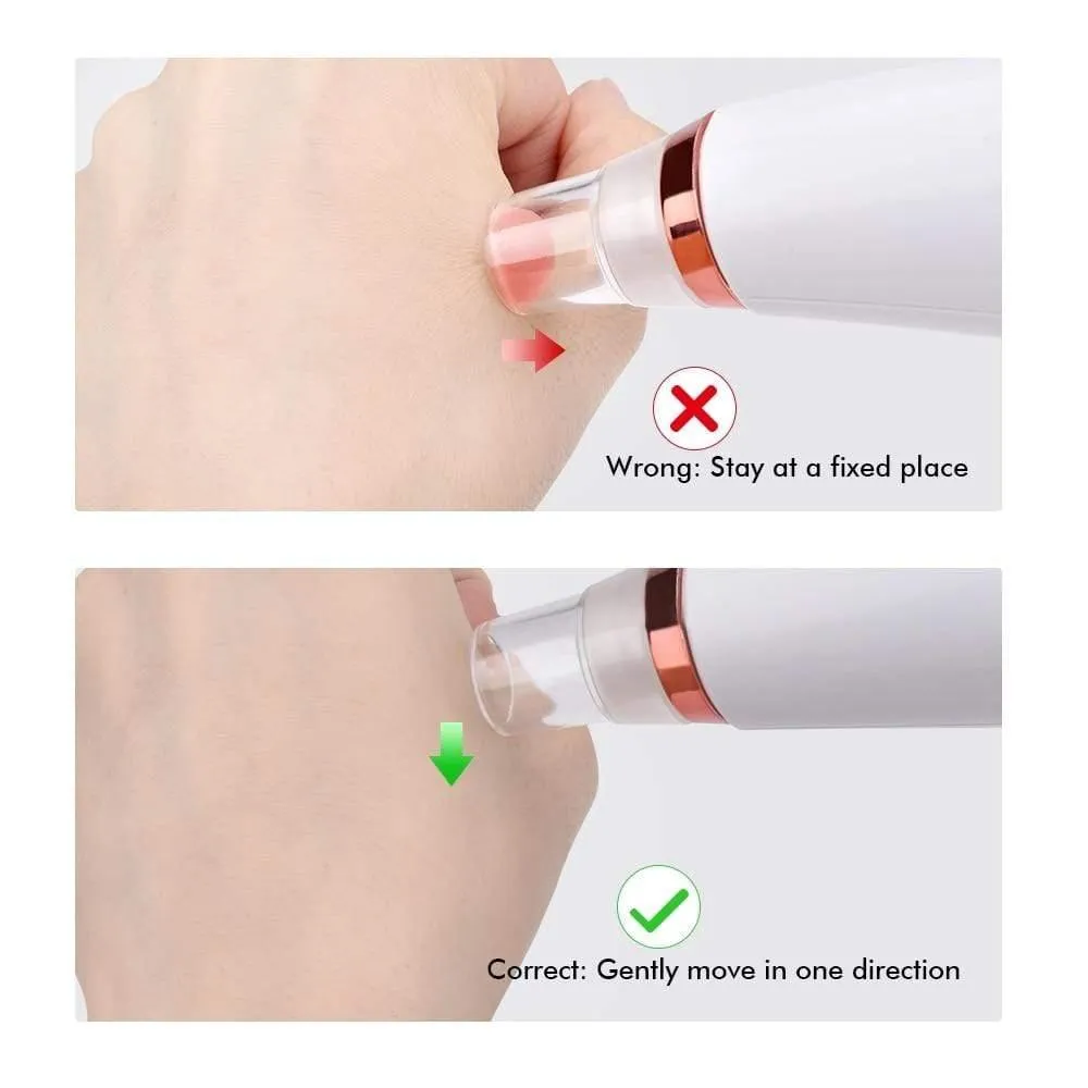 Blackhead Remover Vacuum Pore Cleaner