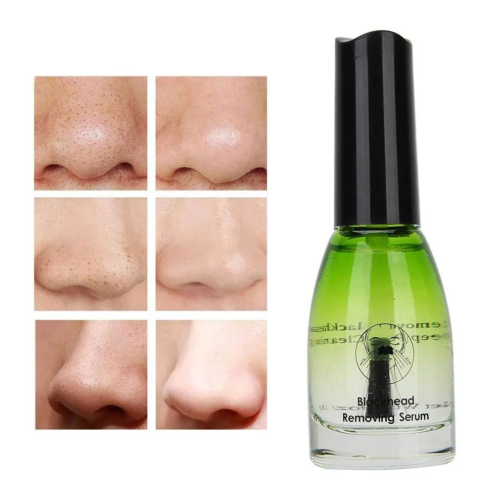 Blackhead Removing Serum, Purify Pores Blackhead Export Liquid with Blackhead Removing Paper,Deep Pore Cleaning Tool Face Skin Care 11g