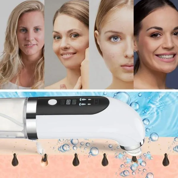 Blackhead Vacuum Facial Cosmetic Tool