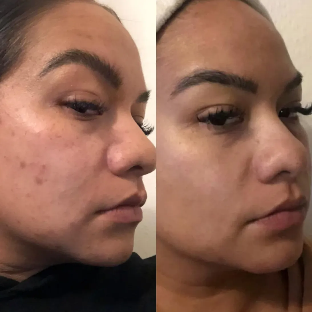 Crème Rescue Serum | PMU & Microblading Aftercare