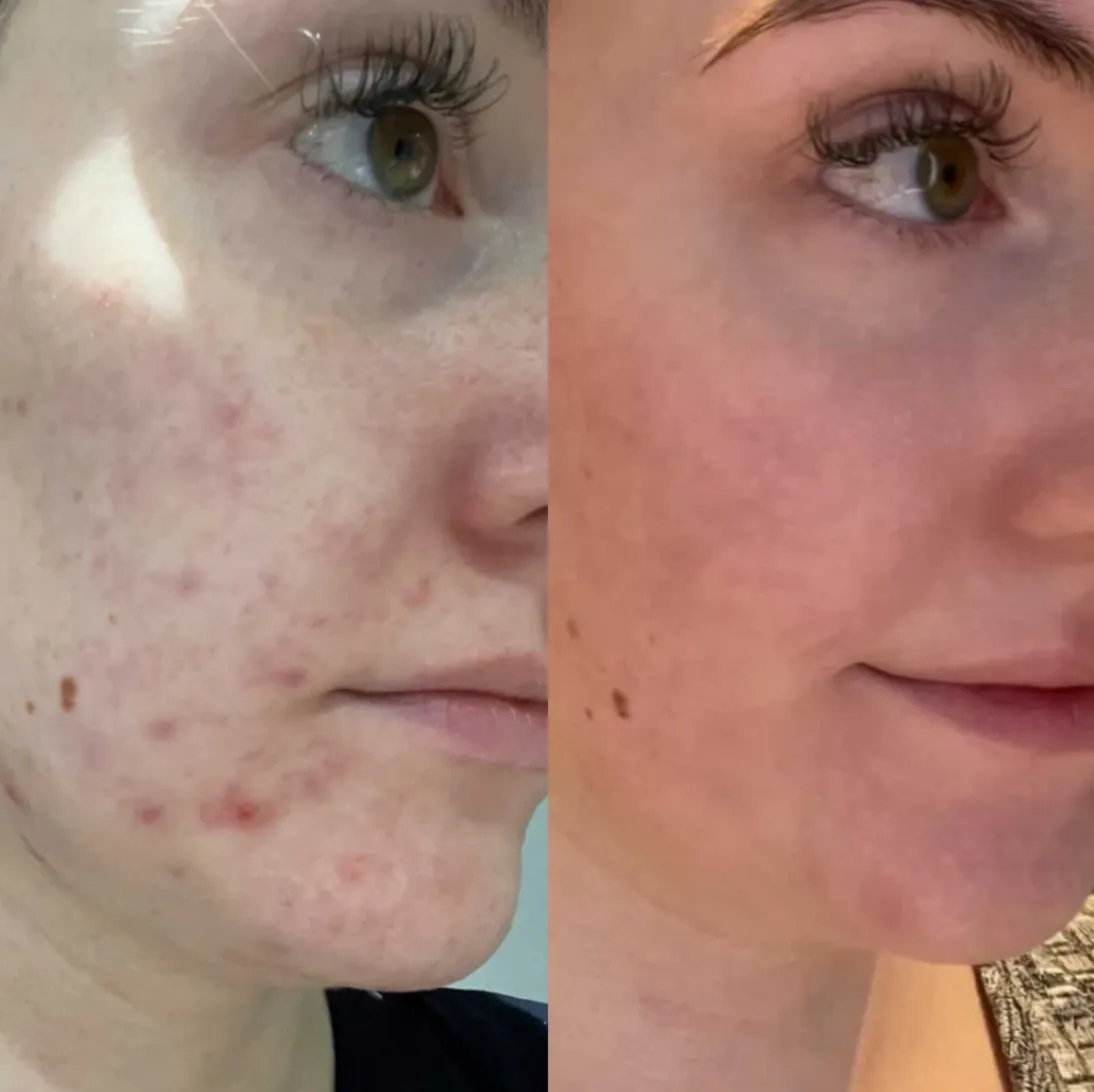 Crème Rescue Serum | PMU & Microblading Aftercare