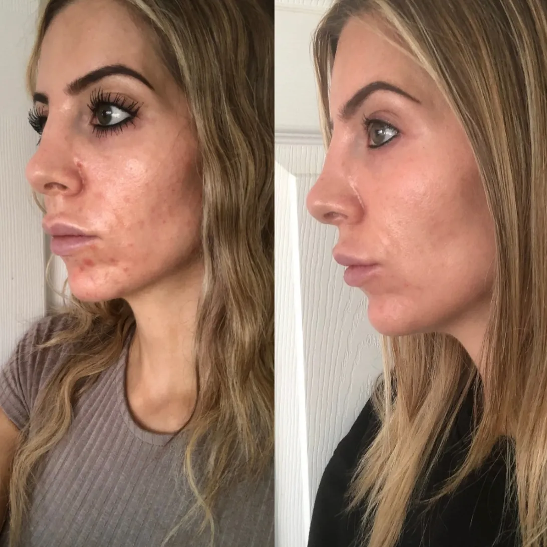 Crème Rescue Serum | PMU & Microblading Aftercare