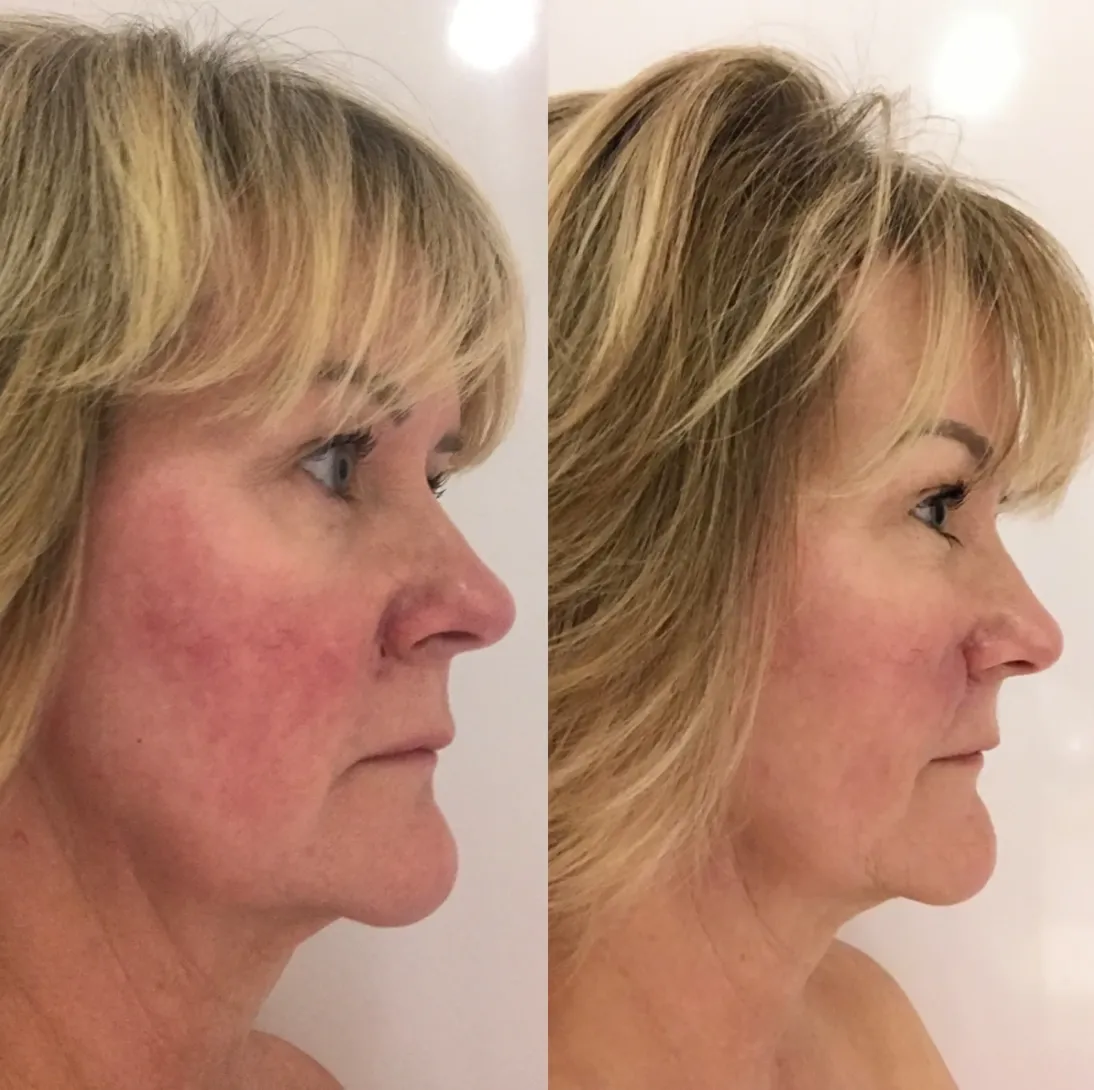 Crème Rescue Serum | PMU & Microblading Aftercare