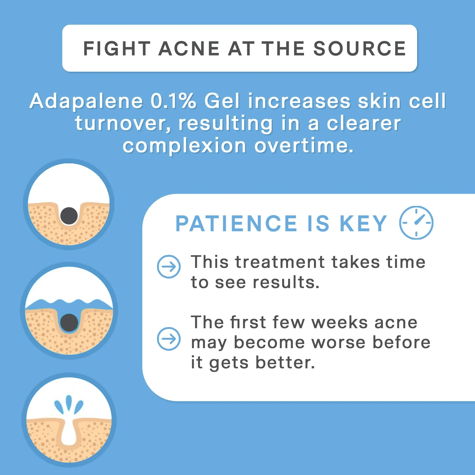 Curist Adapalene 0.1% Acne Gel Topical Retinoid Acne Medicine - Prevent Acne, Whiteheads, Blackheads, & Clogged Pores - Adapalene Retinoid Acne Treatment For Face (2 Pack)