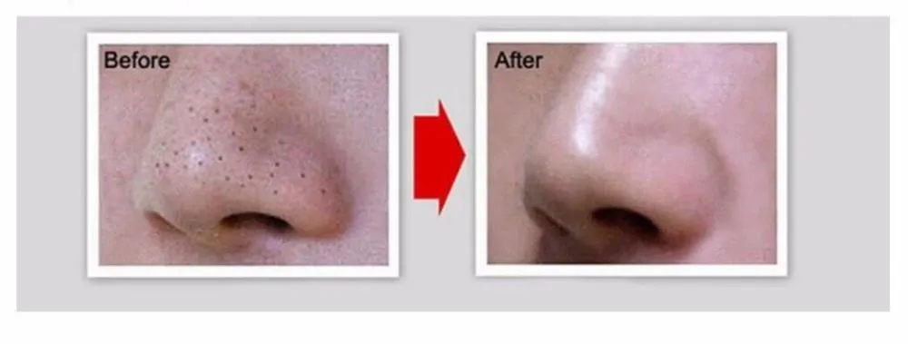 Deep Cleansing Purifying Peel Off Black Facial Mask