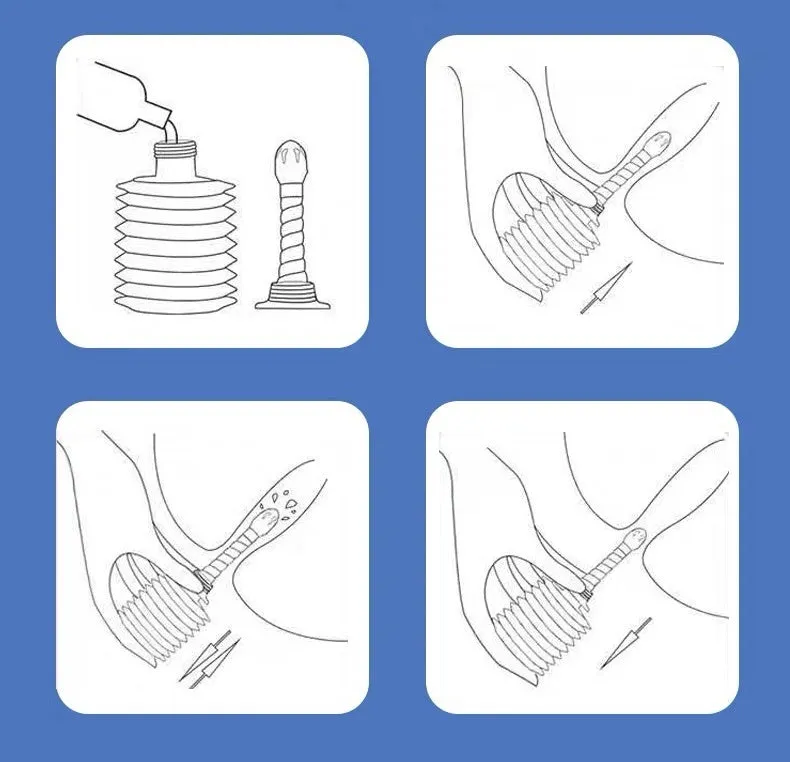 Disposable Vaginal Irrigator Girls Private Parts Gynecological Vaginal Cleaner