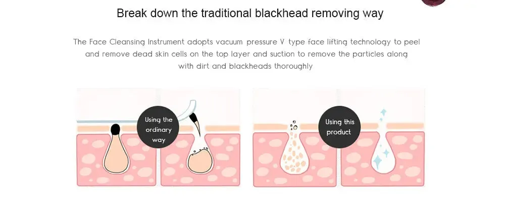 Electric Acne Blackhead Remover Skin Vacuum-Electric Acne Remover