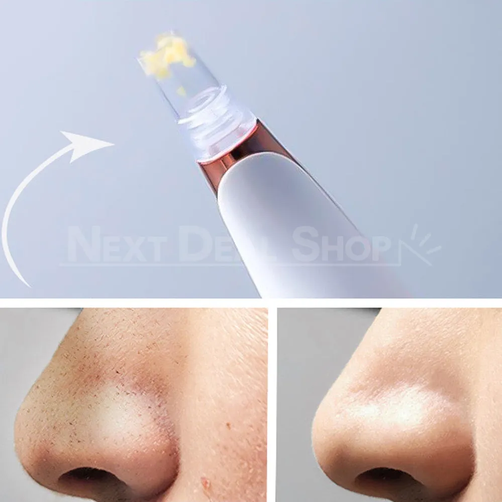 Electric Blackhead Remover Pore Vacuum