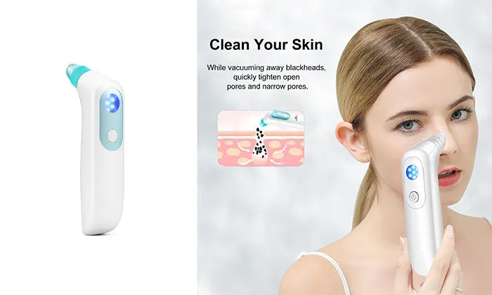 KD802P Blackhead Remover