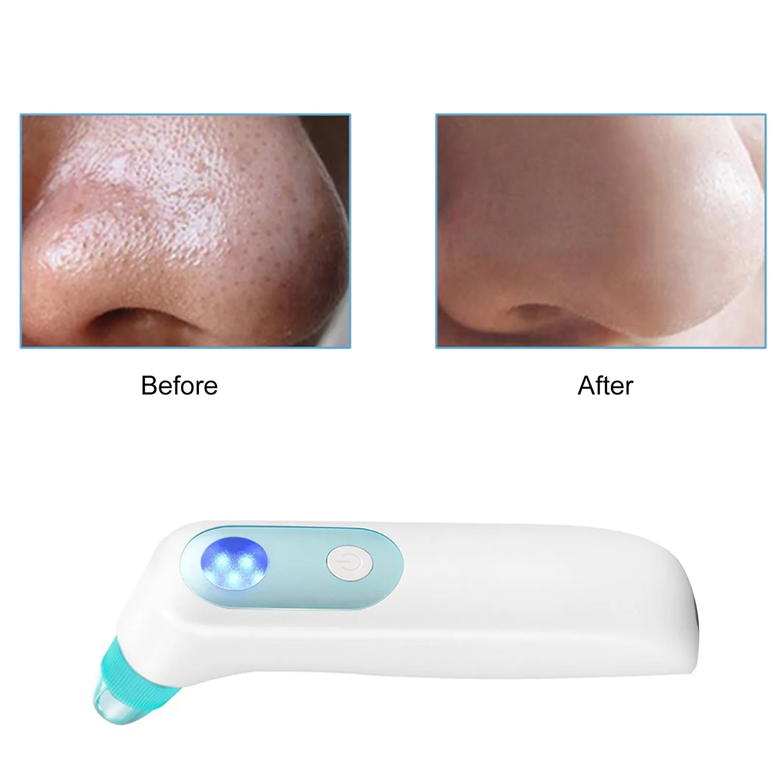 KD802P Blackhead Remover