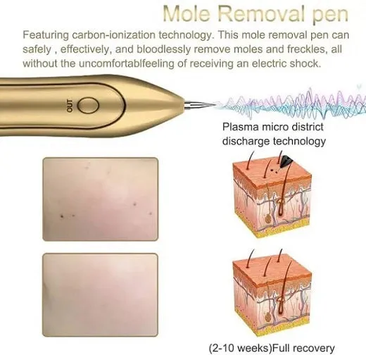 Laser Plasma Freckle and Mole Dark Spot Remover Pen