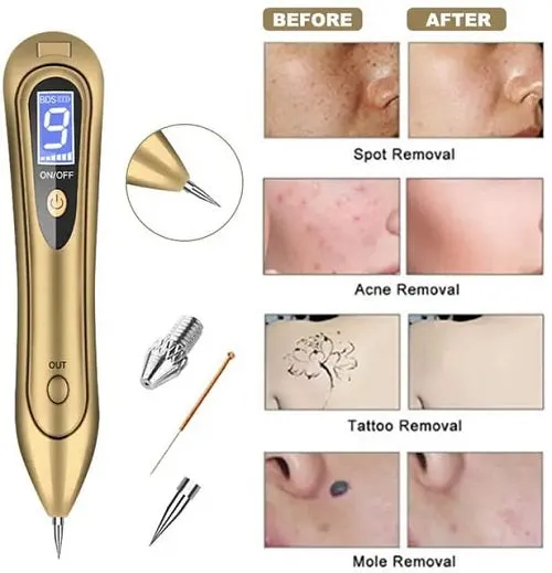 Laser Plasma Freckle and Mole Dark Spot Remover Pen