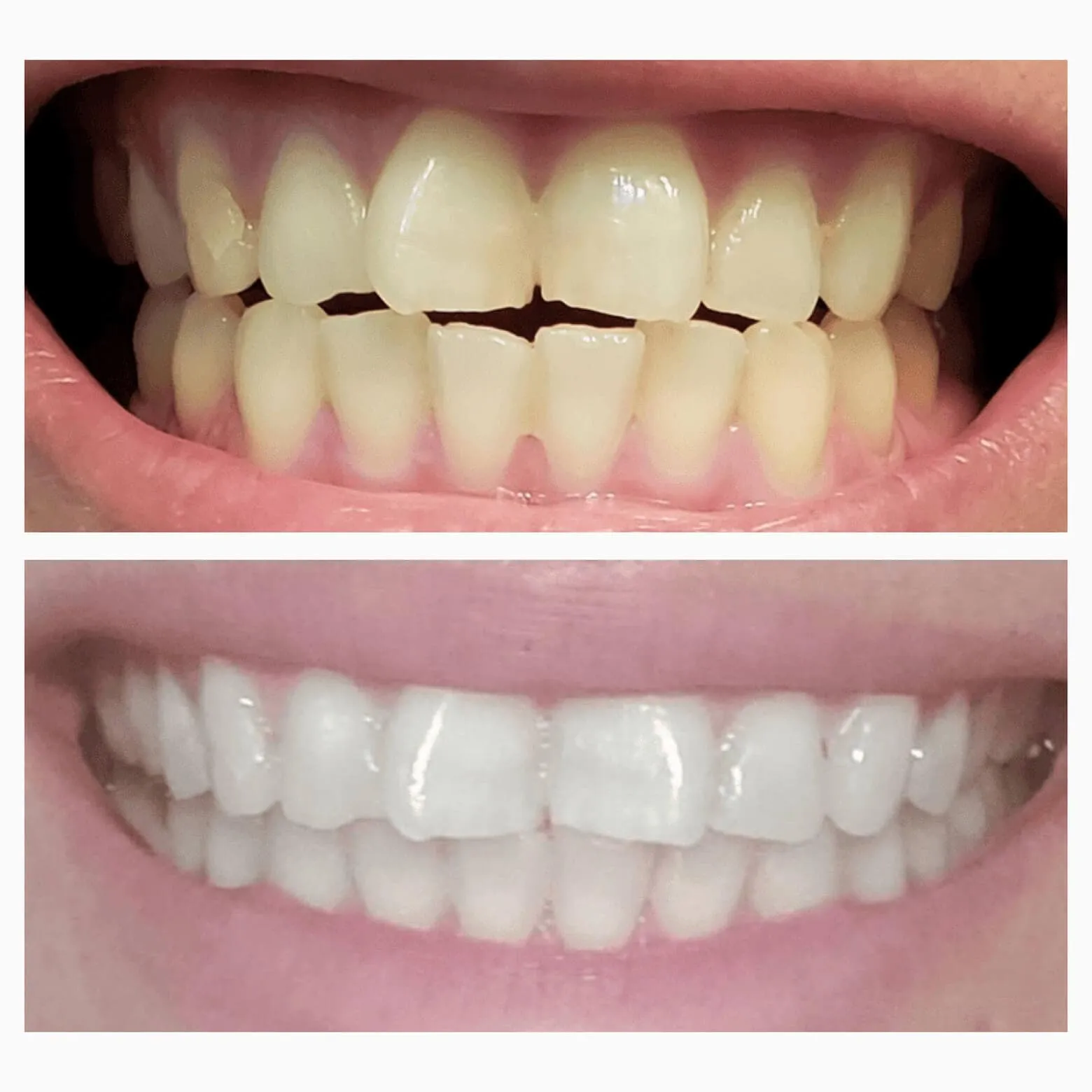 Magic Toothpaste Whitening Booster Powder (B2B)