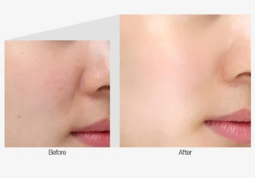 MEDI PEEL Mezzo Filla Eye Serum 30ml