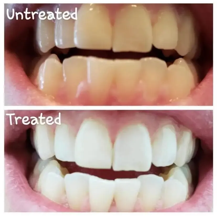 Nu Skin AP-24 Whitening Fluoride Toothpaste 2 Pack