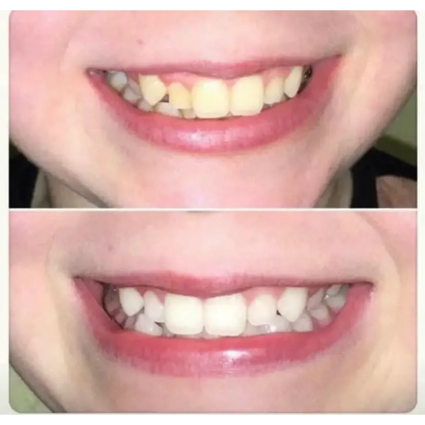 Nu Skin AP-24 Whitening Fluoride Toothpaste 2 Pack