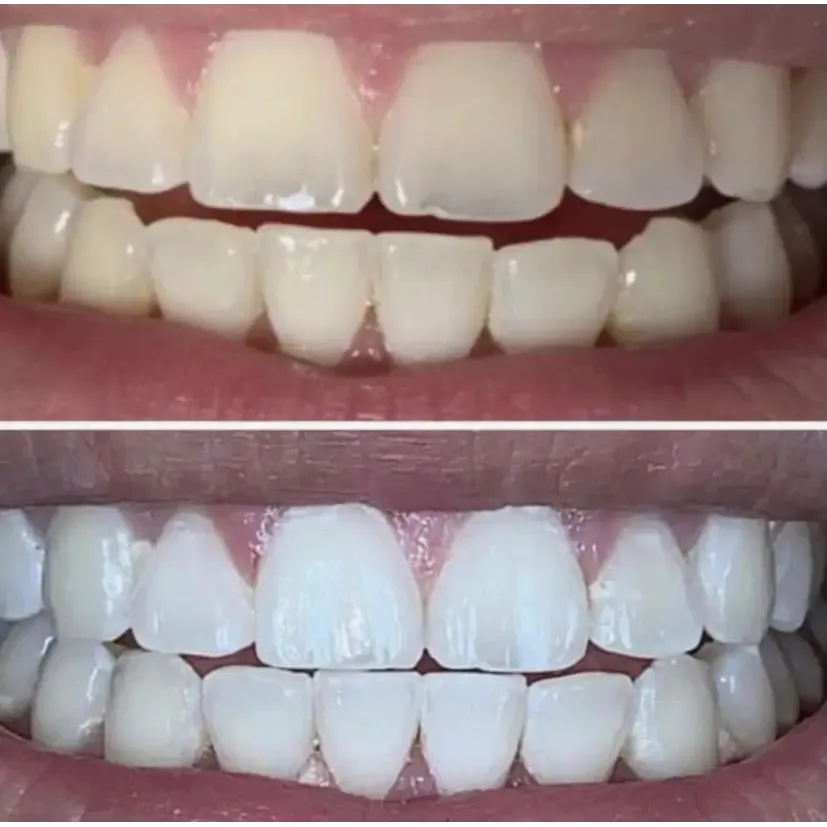 Nu Skin AP-24 Whitening Fluoride Toothpaste 2 Pack