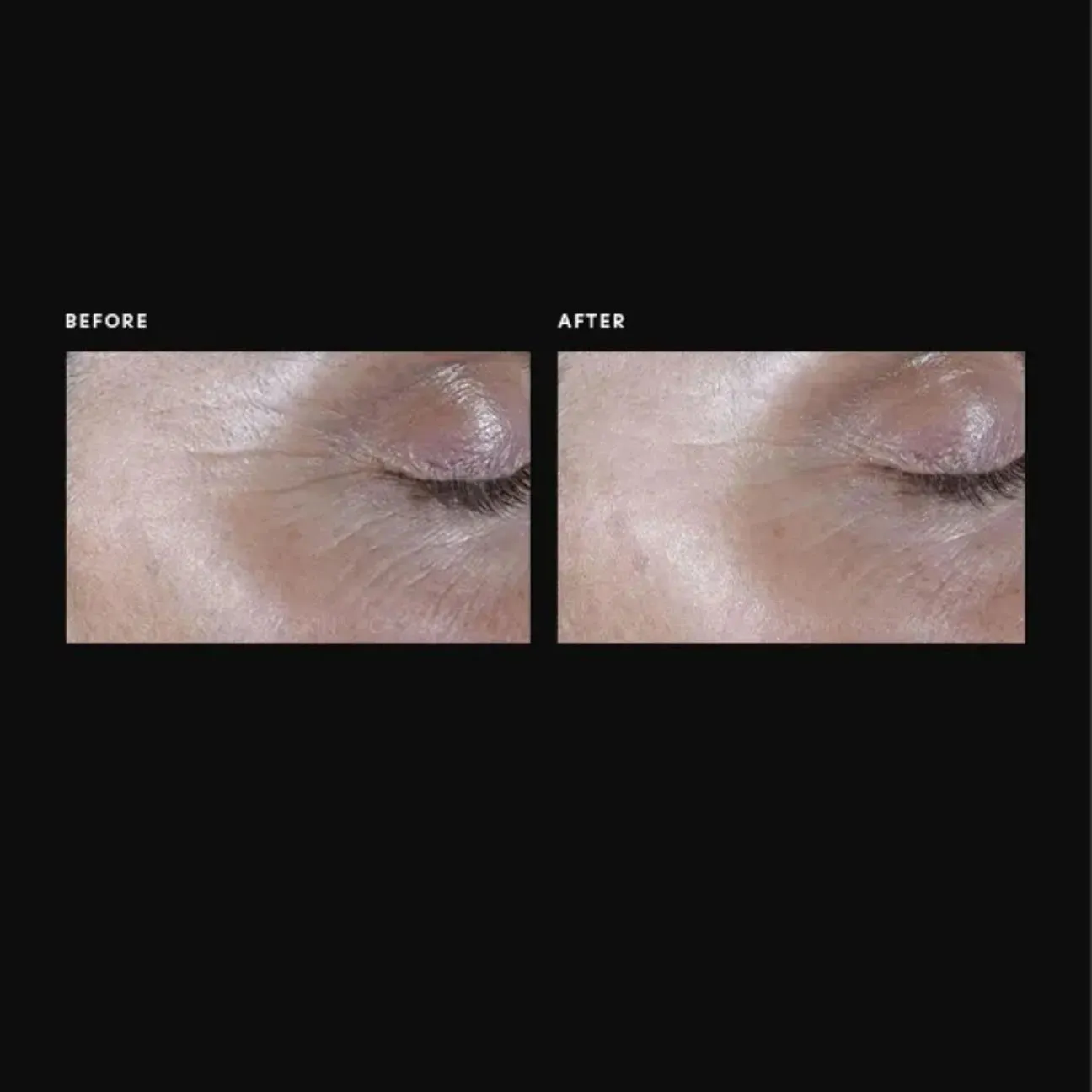 PCA ExLinea® Pro Peptide Serum