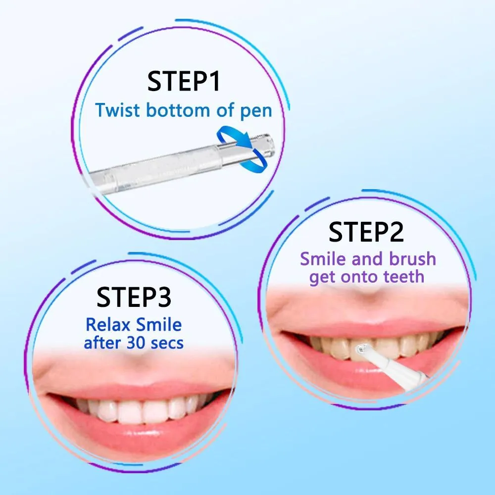 Teeth Whitening 5 Pen Kit 18% CP (Made In USA)