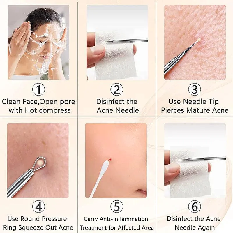 Ultimate Blackhead Removal Kit for Flawless Skin Solutions