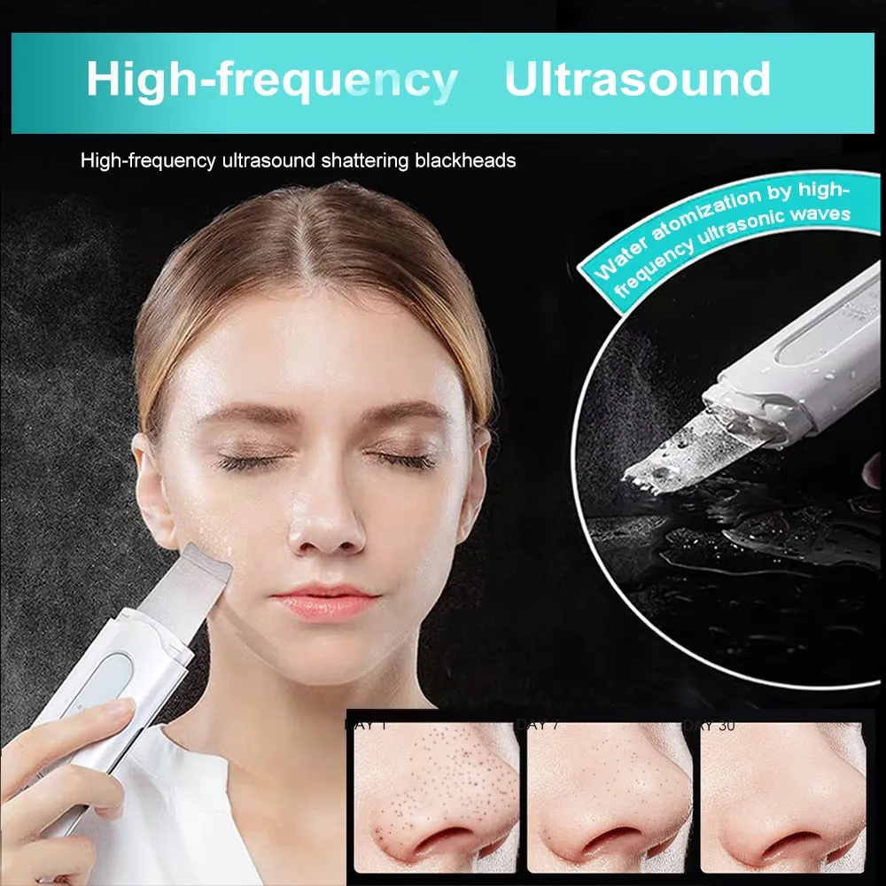 Ultrasonic Scrubber