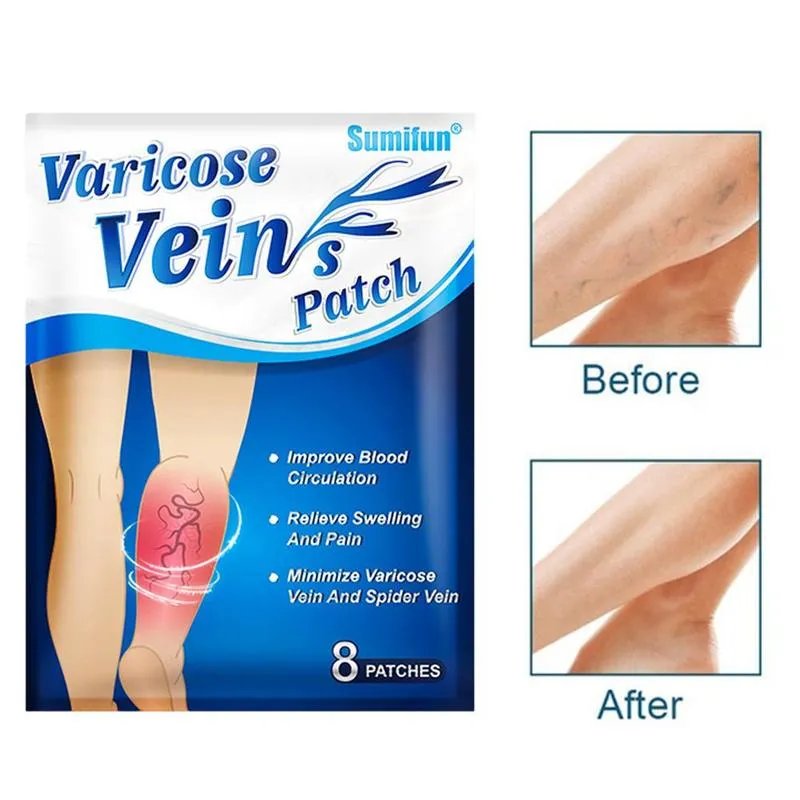 VarixOut Instant Relief Patch