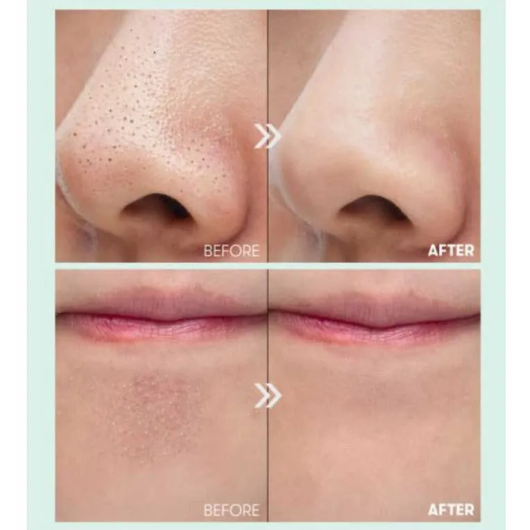 VT Cica Blackhead Cleaner 100ml